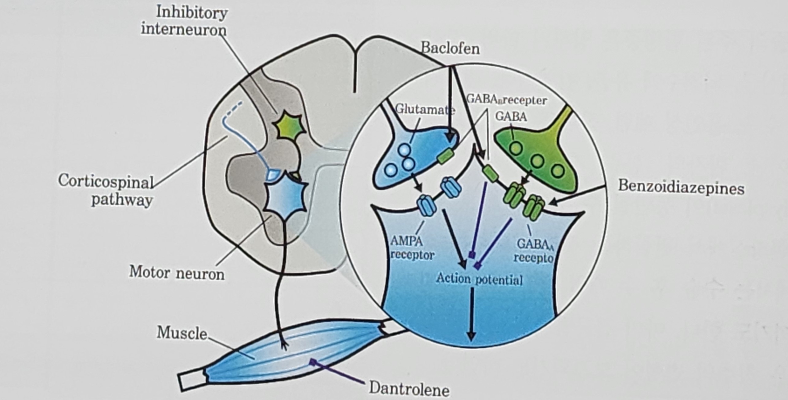 뇌성마비의 수술적 치료2