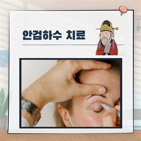 안검하수 비용