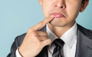 구순염이 좀처럼 낫지 않는 이유