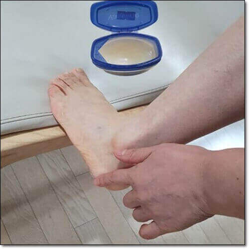 바셀린 효능