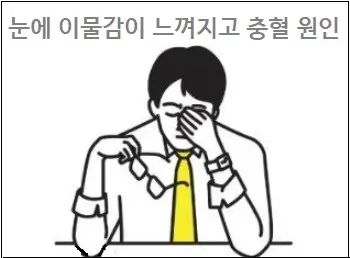 눈에 이물감이 느껴지고 충혈 원인