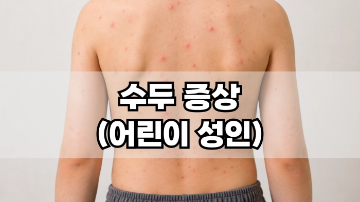 수두 증상