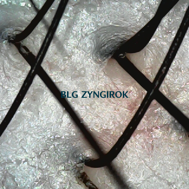 피나모아 복용 22주차 - 뒷머리 두피 모습이다.