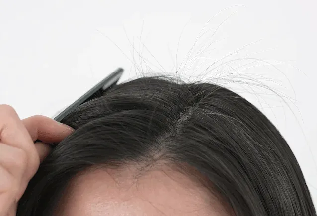 트리코엑스-공식-구매