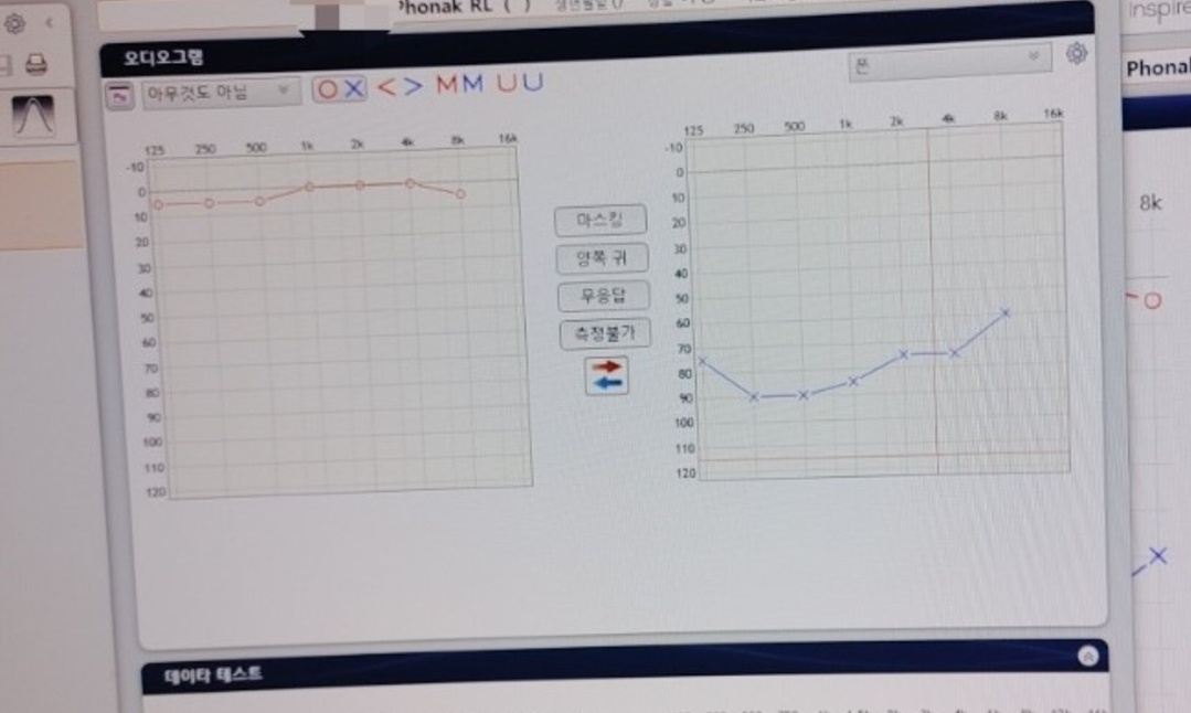 한쪽귀 난청 장애등급 이럴때는 크로스 보청기