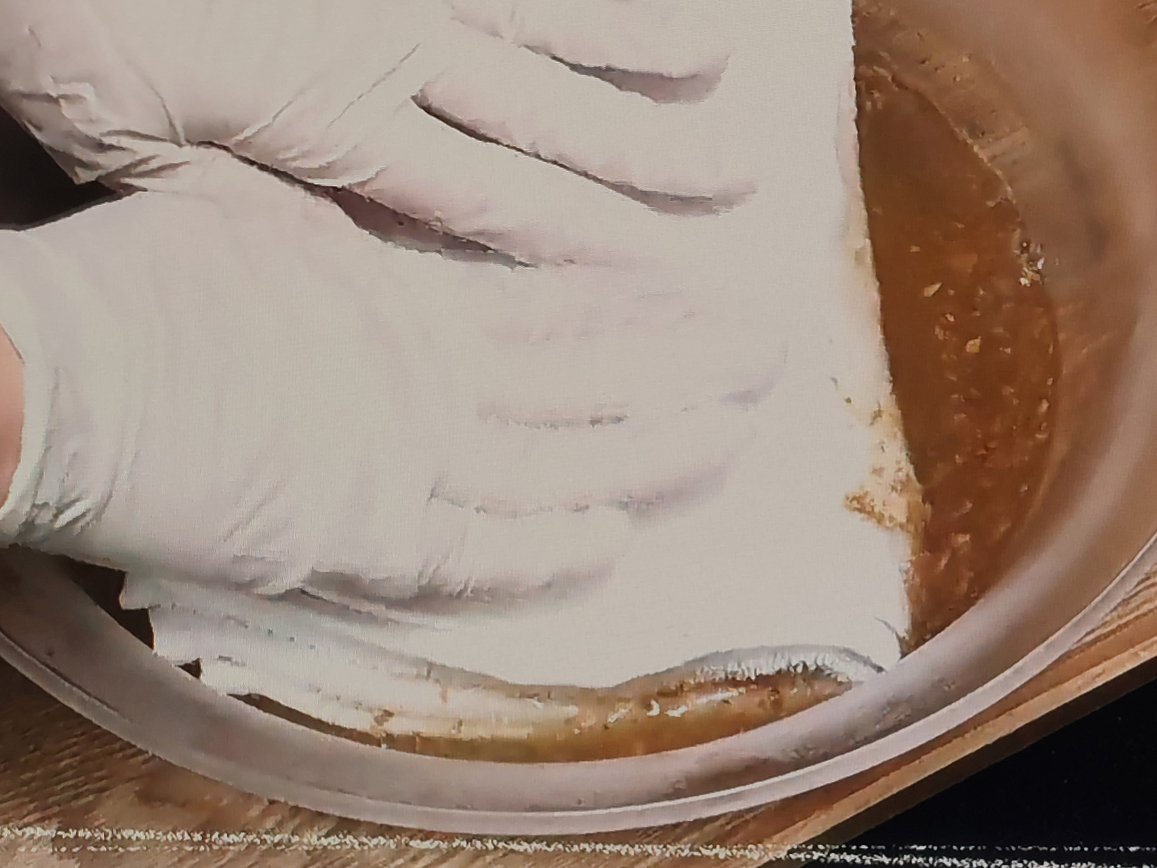생강 찜질 