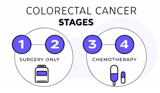 대장임 치료과정