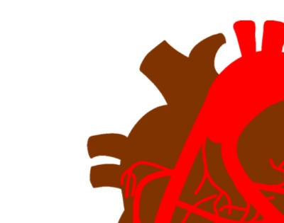 관상동맥 석회화 증상