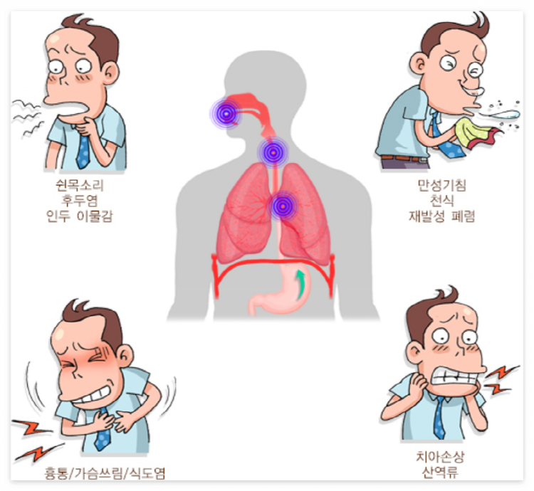역류성식도염 증상