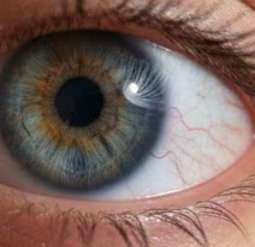 비문증 치료방법