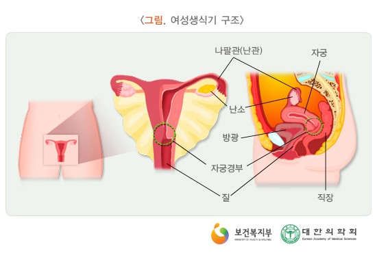 여성질환: 불임증- 자가진단, 원인, 증상, 치료방법.
