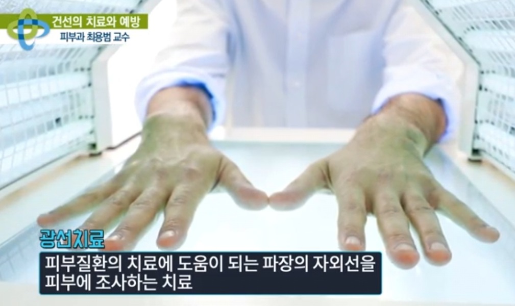 피부-명의-최용범-교수