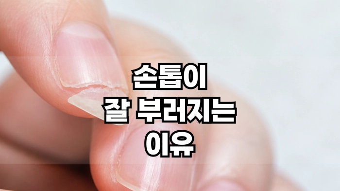 손톱이 잘 부러지는 이유