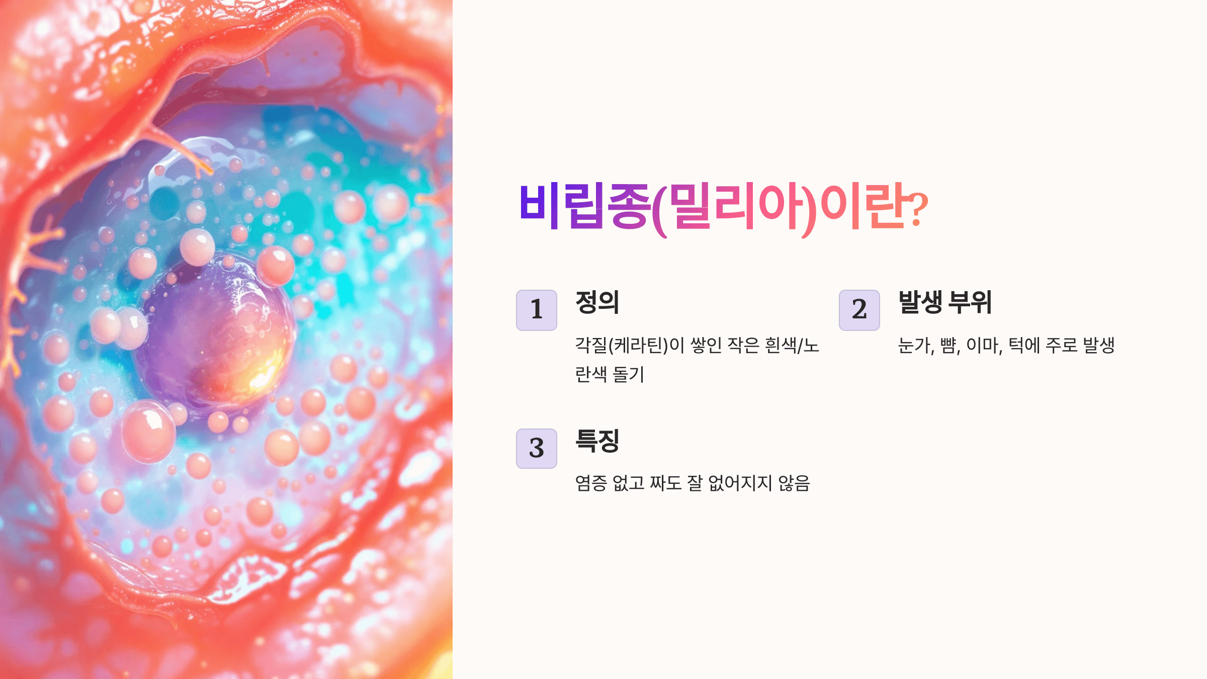 비립종과 관련된 사진입니다.