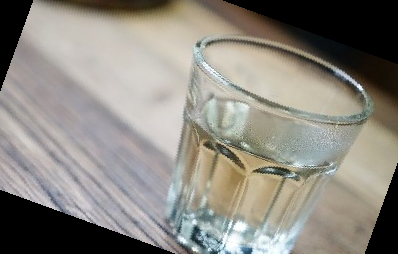 피똥사는 이유 대장암