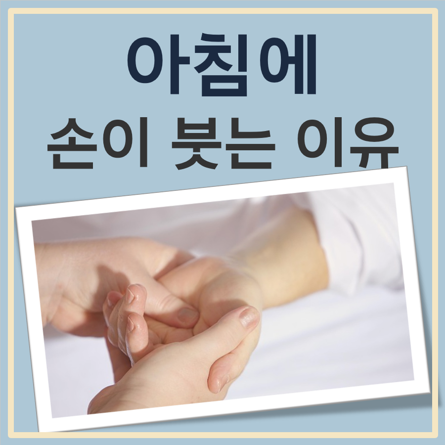 아침에 손이 붓는 이유
