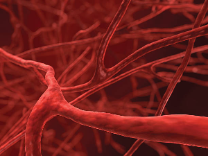 Midlife Vascular Health: Start with Carotid Artery Care.