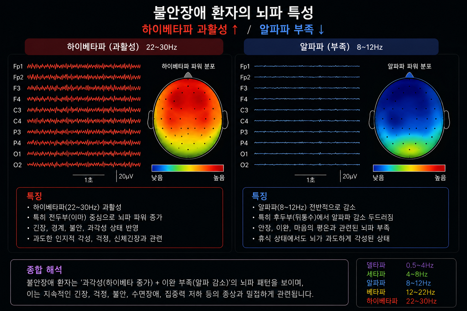 불안장애 환자의 뇌파특징