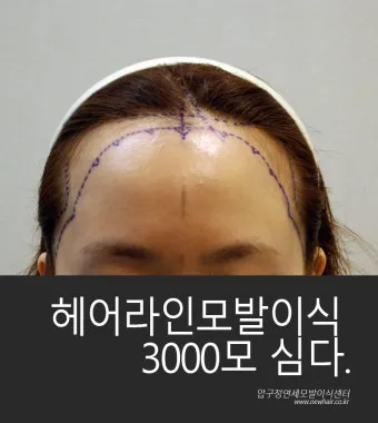 이마가 넓은 여자 관상 특징과 해석_6