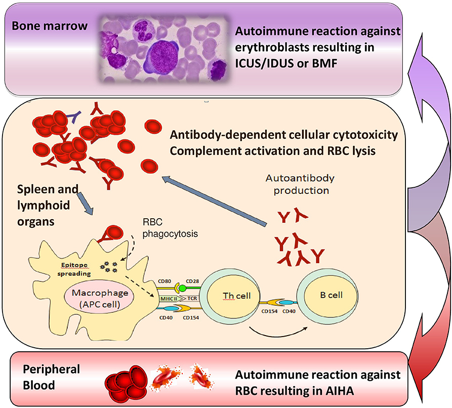 자가면역 용혈성 빈혈에서 Coombs 검사의 역할과 한계