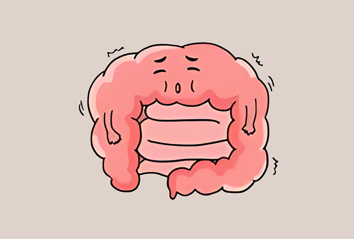 소화-불량이-생긴-장의-모습