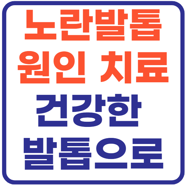 노란 발톱 원인과 치료방법 - 건강한 발톱 되찾기