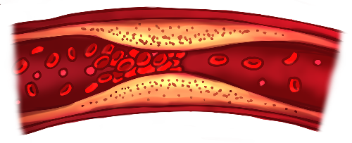 돌외잎 효능&amp;#44; 부작용&amp;#44; 먹는 법 알아보기