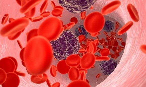 Basophil 수치