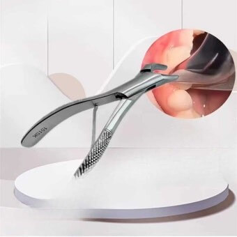 치과에서-이빨-발치-도구지만-무섭게-셩겼음