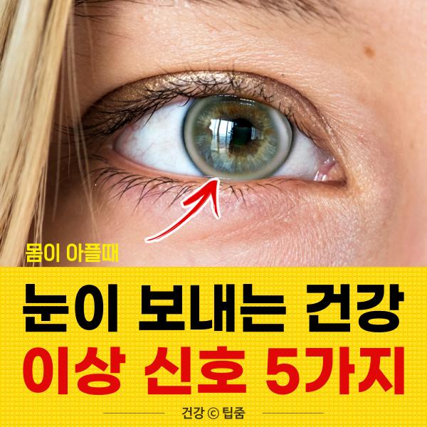 몸이 아프다고 눈이 보내는 건강 이상 신호 5, 팁줌