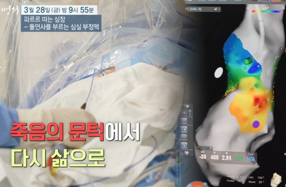 심실부정맥