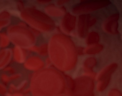 관상동맥 석회화 증상