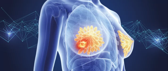 인공지능 흉부 유방암 검사 판독