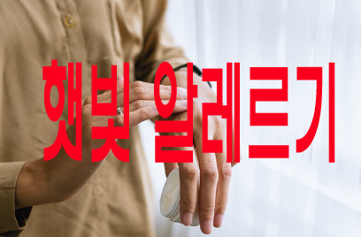 햇빛 알레르기