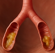 가래가 생기는 원인