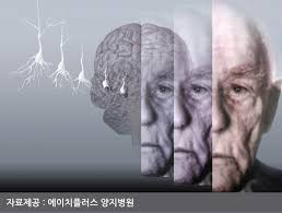 치매 상황에서 어떤 방법이 유리할까? -기억이없다