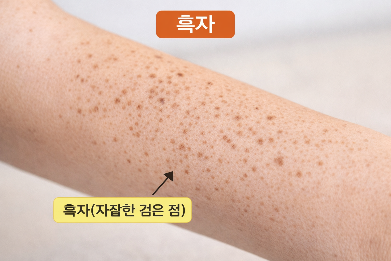 흑자,점
