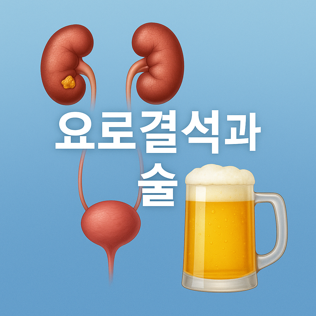 요로결석과 술 링크