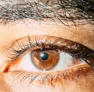 녹내장 치료법 진단 기준 합병증