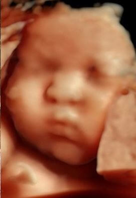 진태현 박시은 아기 딸 태은