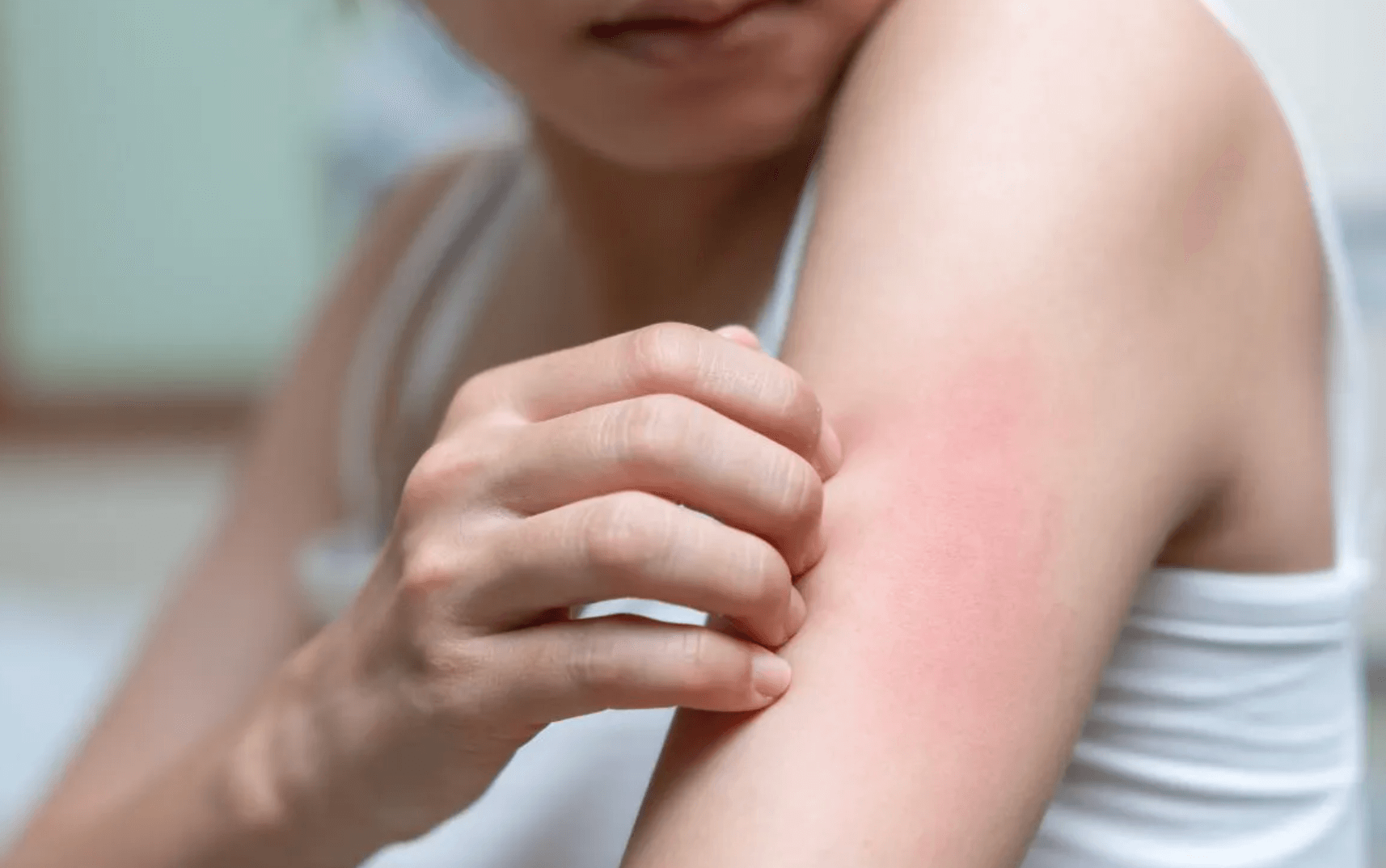 온몸이 간지러움 흔한 원인