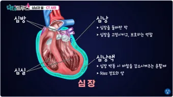 심장에 물이 차는 이유와 관련 질병_3