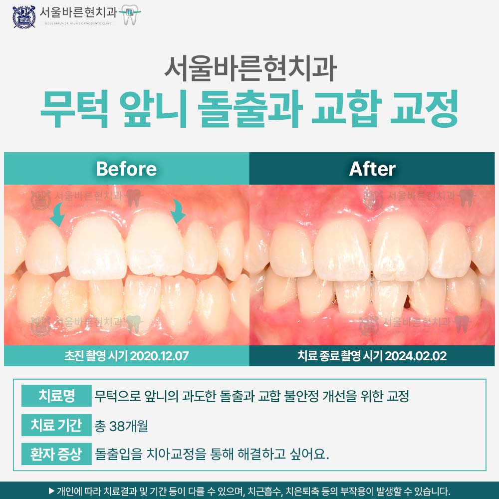 부산해운대교정치과