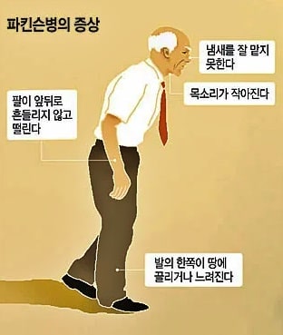파킨슨병 증상