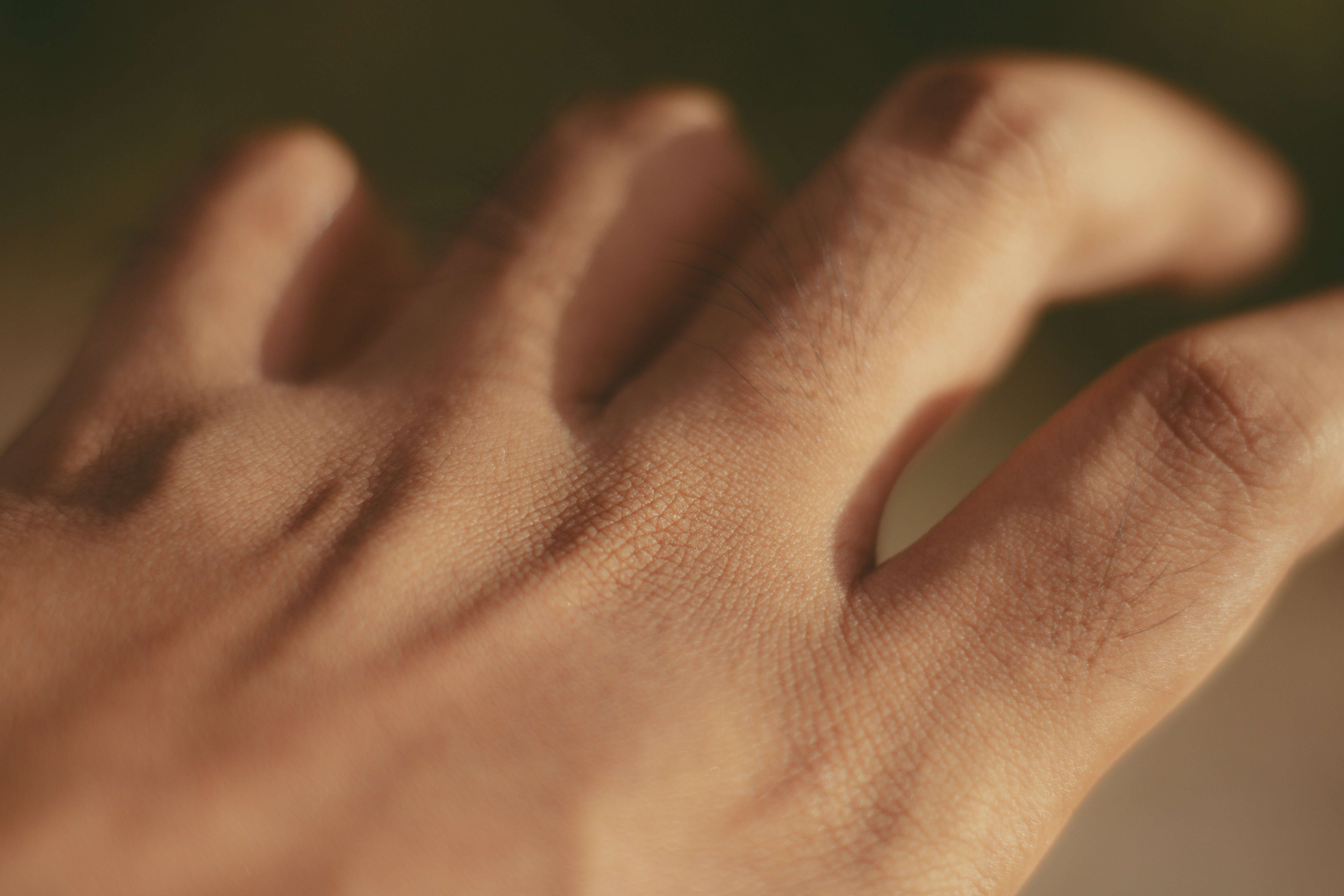 모공이 커지는 원인