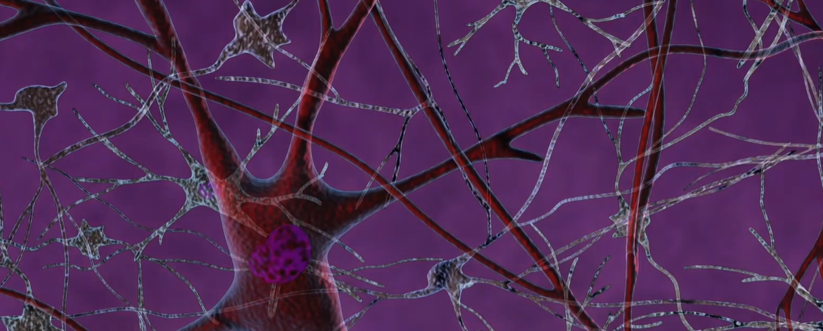 뇌경색 전조증상