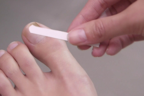 발톱 무좀으로 약을 처방 받았는데, 어떻게 써야하는지 모르겠다 feat. 로세릴 네일라카 바르는법