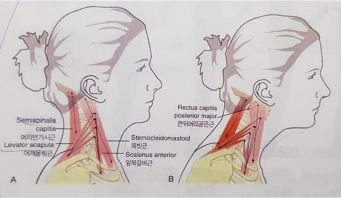 구강 근기능 치료(OMT) - "아름다워지고 건강해지는 얼굴 운동"