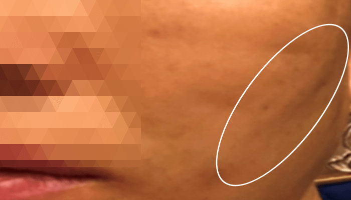 얼굴이-울퉁불퉁한-여성