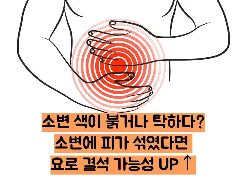 요로결석 증상